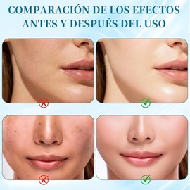 Crema Hidratante Centella Asiatica，hidratante facial，Cream Korean，hidratación profunda y reparadora，adecuada para todo tipo de piel,Mejora eficazmente
