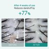 lilyeve [lilyeve]Scalp:Turn Cica PDRN Brush Ampoule 100ml