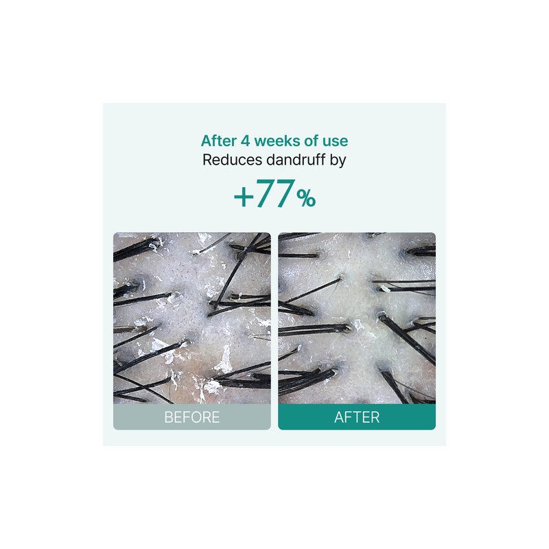 lilyeve [lilyeve]Scalp:Turn Cica PDRN Brush Ampoule 100ml