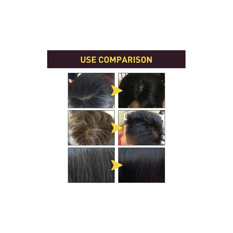 Black Hair Shampoo Negro 3en1 Cubre Canas Anticaida Calidad