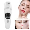 Face Skin Scrubber Vibration Face Peeling Machine Ultrasonic Exfoliating Skin‑Care