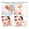 Unic Kit Anti Acné Extractor De Puntos Negros Y Espinillas
