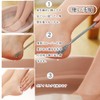Forahome Exfoliating Remover, Foot Exfoliating, 2-in-1 Function, Octopus Exfoliating, Heel