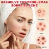 180pzs Parches Pegatinas Para Acné Absorbentes Pimple Patch