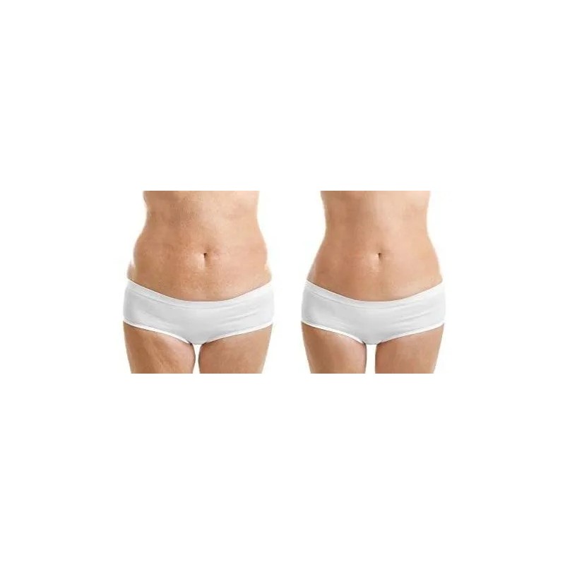Crema Anti Estrias Natural Para Embarazo 90ml Cuidado Piel Neutra