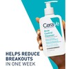 Cerave Acne Control Cleanser Facial Cleanser For Pimple Remover 237ML