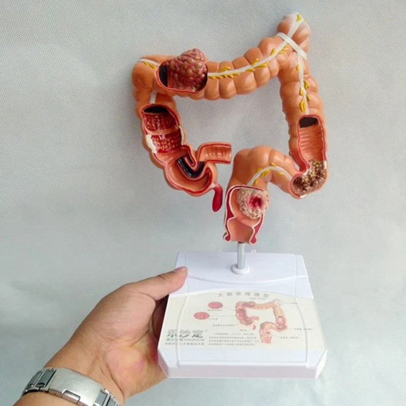 Modelo Didáctico, Modelo De Anatomía Visceral Del Intestino