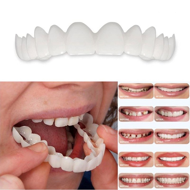 2 Pairs, Temporarily Adjustable for Men and Women, Regain Confidence