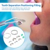 Matriz de perfil de sección dental de 100 / caja,