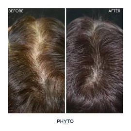 Phyto Phytocyane Hair Thinning Dietary Supplement 84 Capsules (12-Week Supply)