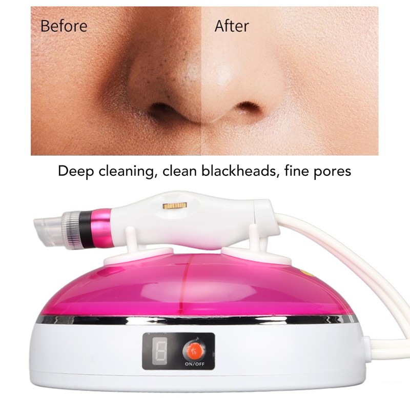 Facial Pore Sucker 3 Modes Adjustment ABS Housing Deep Cleaning