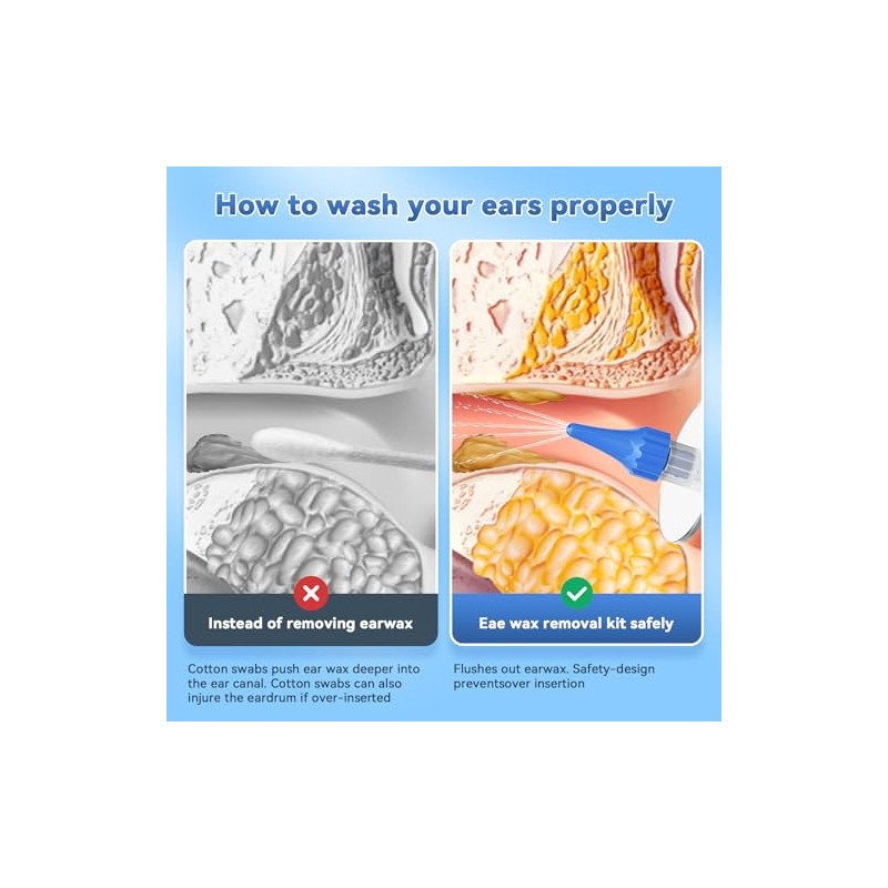 Qimic Ear Wax Removal Kit, Qimic Ear Cleaner, Ear Wax