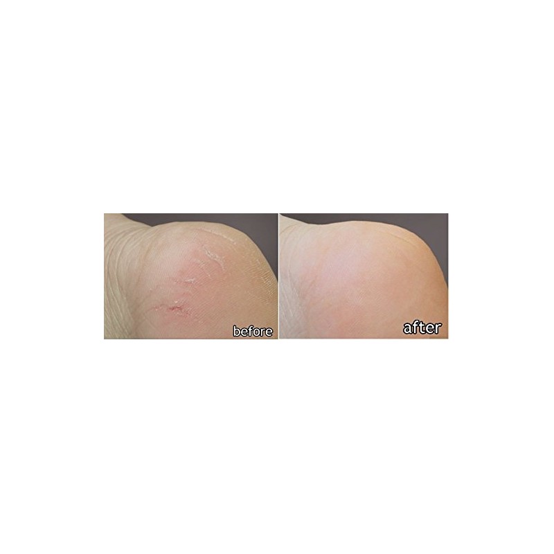 DK ELAN Silky Smooth Special Set (Face-Body-Foot) for Dry, Rough,