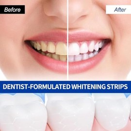Mydear Tiras Blanqueadoras Dientes Piezas Whitening Strips Profesional Blanqueador Dental Eliminar Manchas Dentales Blanquear Forma Pida Caf Vino