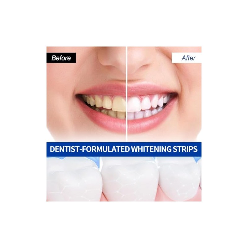 Mydear Tiras Blanqueadoras Dientes Piezas Whitening Strips Profesional Blanqueador Dental