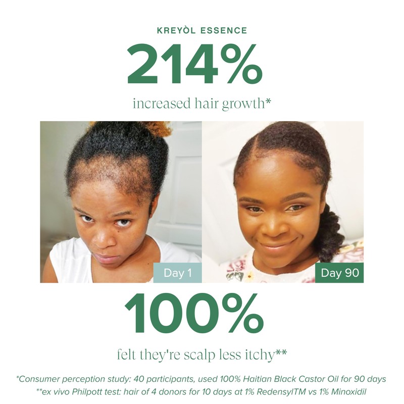 Kreyol Essence - Save Our Scalp Serum (S.O.S Serum) -