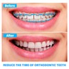 Dental Orthodontic Elastic Chain Power Chains for Brace, Annhua Dental