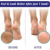 PediFix Soaking Crystals Foot Bath - (6) 1 oz. packets