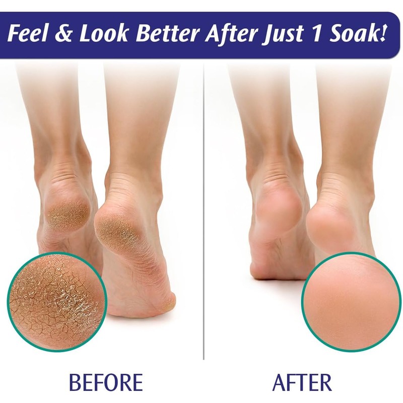PediFix Soaking Crystals Foot Bath - (6) 1 oz. packets