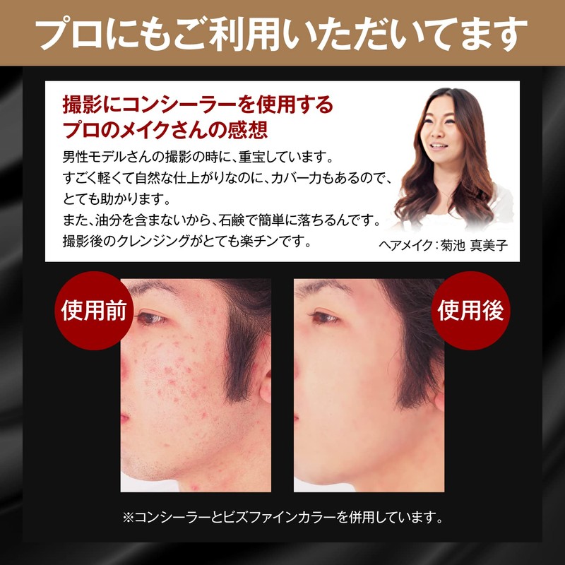 Zas Men's Concealer (Dark), Stains, Bruises, Moles, Acne Scars, Freckles,