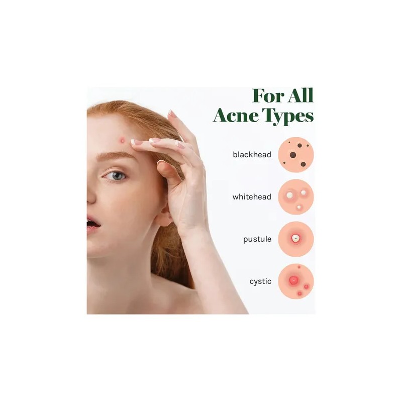 Cover Healing Invisible Acne Patch Blemish Spot, Treatment,