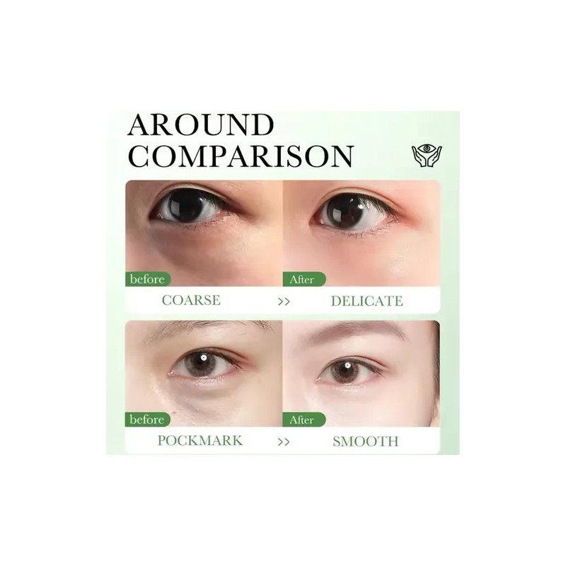 Crema Contorno Ojos Centella Asiática Antiojeras Antiarrugas Tipo De Piel