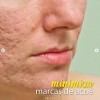Chamantra Anestesia Para Tatuaje Y Balsamo De Curacion Kit