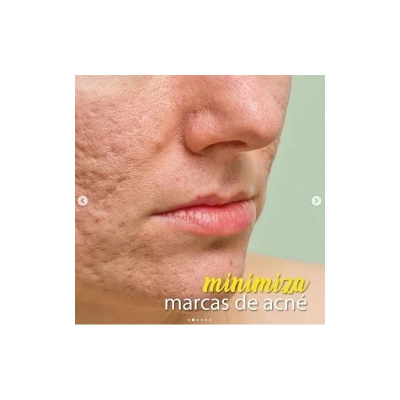 Chamantra Anestesia Para Tatuaje Y Balsamo De Curacion Kit