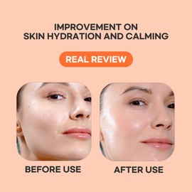 Epielle Vitamin C Serum Sheet Masks (5pk) | Korean Skincare | Facial Sheet Mask | Kbeauty, Spa Gifts for Women