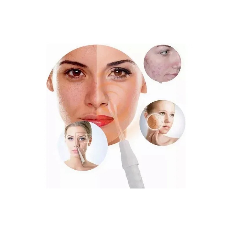 Dispositivo Belleza Alta Frecuencia Savefree Facial Care Portátil Electrodos