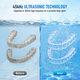 Ultrasonic Cleaning Device Tooth Splint with UV Sterilisation, 45 kHz High Frequency, 4 Modes UV Tooth Splint Cleaning, 200 ml, Dental Cleaning Container, Retainers, Aligners etc. (Black)