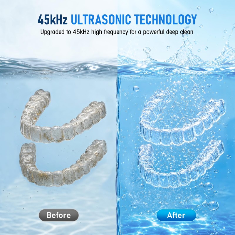 Ultrasonic Cleaning Device Tooth Splint with UV Sterilisation, 45 kHz