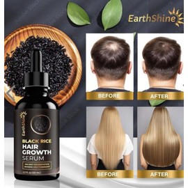 EarthShine Rice Water for Hair Growth Kit With Roller Black Rice Fermented 2 Oz