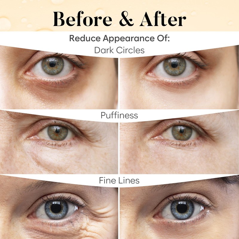 Vitamin C & Caffeine Under Eye Gel Patches, Under Eye