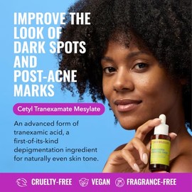 Good Molecules Discoloration Correcting Serum 75ml - Tranexamic Acid and Niacinamide for Dark Spots, Acne Scars, Sun Damage, Hyperpigmentation, and...