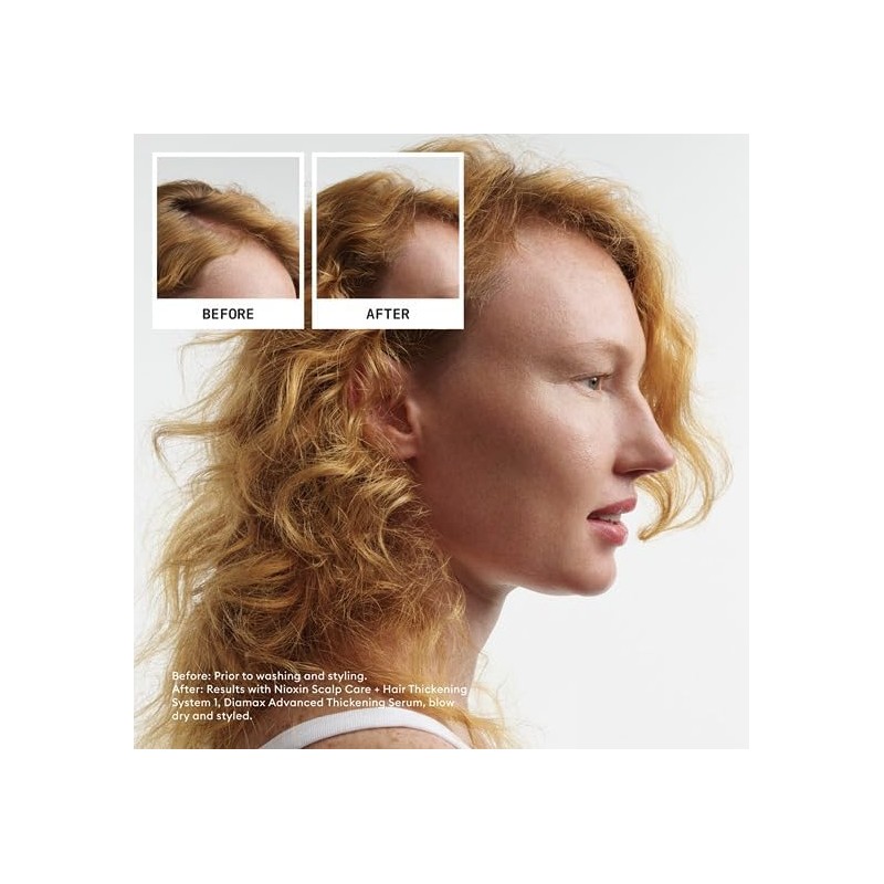 Nioxin Hair System Care Trial Kit, System 1 (Fine Hair/