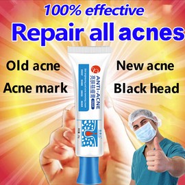 No Brand Acne Cream Acne Treatment Gel Repair Acne Anti Acne Spots Face Repair Comedone Skin Care Acne Removal Gel祛痘膏祛痘霜