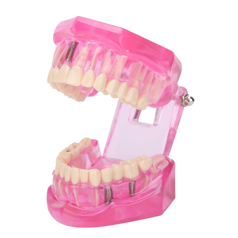 Transparent Adult Teeth Model Pathological Repair Studying Dental Teaching Tools