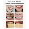 Live Orals PureDia Teeth Whitening Kit - Gel & Mouthpiece