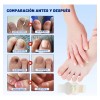30pz Parches Antimicóticos For El Tratamiento De Uñas