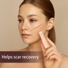 Scar Solutions Silicone Scar Stick with 60% Silicone, Manual Massage