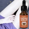El Sérum Decolorante Gze Reduce La Hiperpigmentación Y Las M