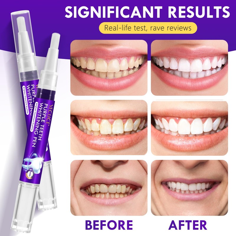 Teeth Whitening Pen 6 Pack, Professional Purple Teeth Whitening Gel