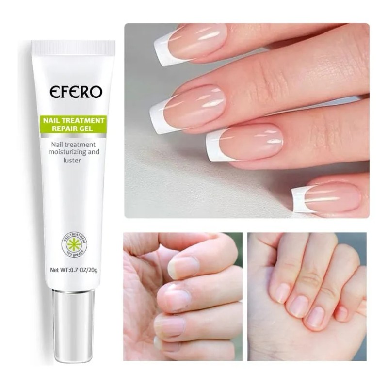 Compuesto completo para tratamiento de tiña Efero Nails, color blanco