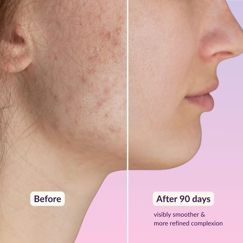 High Strength Retinol Serum - 2,5% Retinol Anti-Ageing Formula with