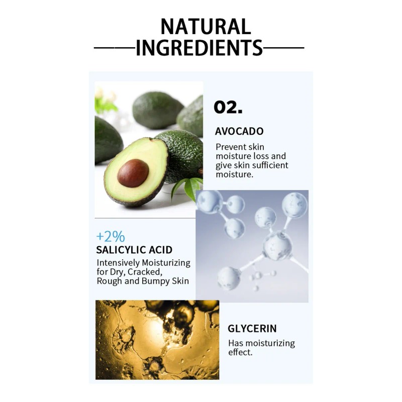 Lanthome Crema De Urea Crema Removedora De Callos De Pies