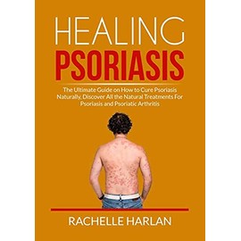 Healing Psoriasis: The Ultimate Guide on How to Cure Psoriasis Naturally, Discover All the Natural Treatments For Psoriasis and Psoriatic Arthritis