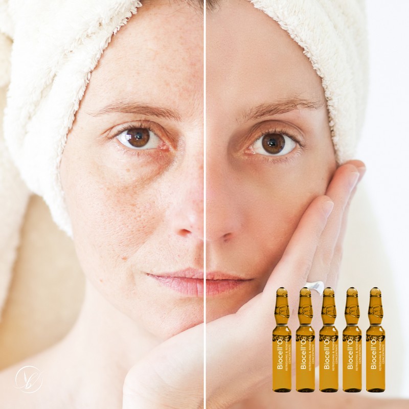 Biocell O2 Ampoule / 바이오셀 오투 앰플