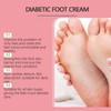 Soft Feet Solution – OUHOE Moisturizing Foot Cream with Aloe