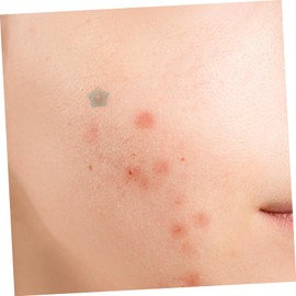 minkissy 2 Sheets Pimple Sticker Remove Patches for Facial Ultra-thin Patches Tool